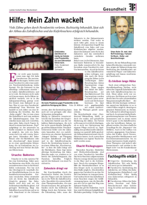 Landwirtschaftliches Wochenblatt Gesundheit Hilfe: Mein Zahn wackelt Viele Zähne gehen durch Parodontitis verloren.