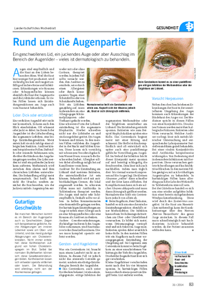 Landwirtschaftliches Wochenblatt GESUNDHEIT Rund um die Augenpartie Ein geschwollenes Lid, ein juckendes Auge oder aber Ausschlag im Bereich der Augenlider – vieles ist dermatologisch zu behandeln.