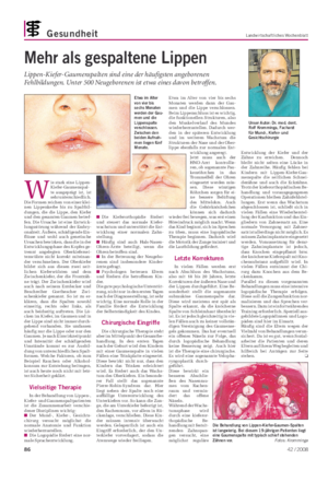 Gesundheit Landwirtschaftliches Wochenblatt Mehr als gespaltene Lippen Lippen-Kiefer-Gaumenspalten sind eine der häufigsten angeborenen Fehlbildungen.