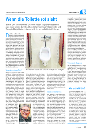 Landwirtschaftliches Wochenblatt GESUNDHEIT Wenn die Toilette rot sieht Blut im Urin kann harmlose Ursachen haben.