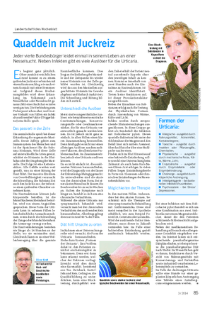 Landwirtschaftliches Wochenblatt GESUNDHEIT Quaddeln mit Juckreiz Jeder vierte Bundesbürger leidet einmal in seinem Leben an einer Nesselsucht.