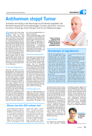 Landwirtschaftliches Wochenblatt GESUNDHEIT B rustkrebs: Mit dieser Diag- nose werden in Deutsch- land jedes Jahr rund 70 000 Frauen konfrontiert.