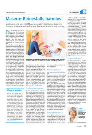 Landwirtschaftliches Wochenblatt GESUNDHEIT D ie aktuelle Masernwelle in Berlin und die Diskussion um den Tod des kleinen Jun- gen an Masern sollten wachrüt- teln.