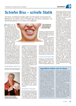 GESUNDHEIT Schiefer Biss – schiefe Statik Zahnärzte und Kieferorthopäden gelten als Orthopäden für die Spitze der Wirbelsäule.