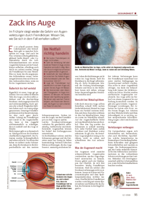 GESUNDHEIT ■ Zack ins Auge Im Frühjahr steigt wieder die Gefahr von Augen­ verletzungen durch Fremdkörper.