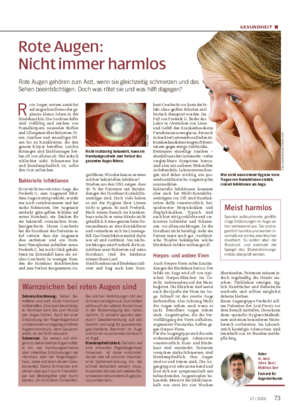 GESUNDHEIT ■ Rote Augen: Nicht immer harmlos Rote Augen gehören zum Arzt, wenn sie gleich zeitig schmerzen und das Sehen beeinträchtigen.