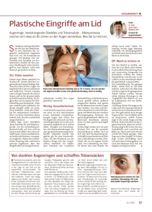 GESUNDHEIT ■ Plastische Eingriffe am Lid Augenringe, herabhängende Oberlider und Tränensäcke – Altersprozesse machen sich etwa ab 40 Jahren an den Augen bemerkbar.