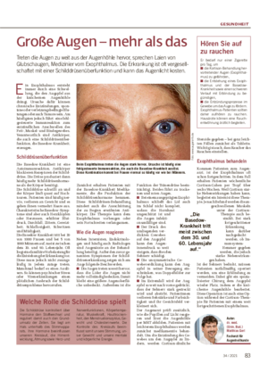 GESUNDHEIT Große Augen – mehr als das Treten die Augen zu weit aus der Augenhöhle hervor, sprechen Laien von Glubschaugen, Medizinier vom Exophthalmus.